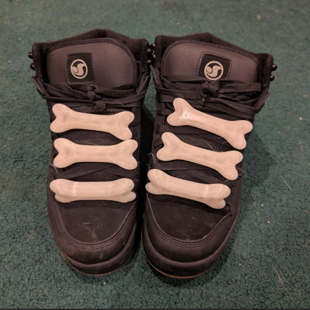 Jeremy Scott x Adidas Glow in the Dark Bone Lace Covers